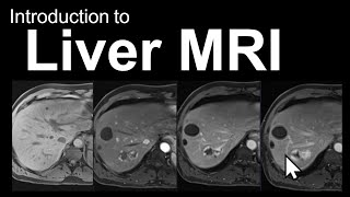 Introduction to Liver MRI Approach and CaseBased Course [upl. by Radbourne]