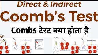 Direct coombs test [upl. by Aleusnoc781]