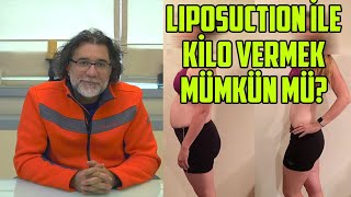 Liposuction İle Kilo Vermek Mümkün mü [upl. by Dier]