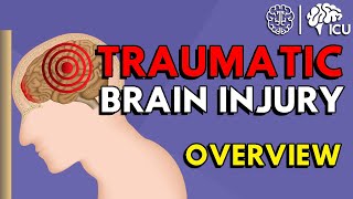 Overview of Traumatic Brain Injury TBI [upl. by Aurie801]