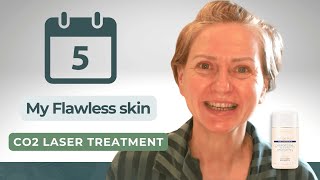 5 Days to FLAWLESS Skin with CO2 Laser Treatment [upl. by Ynnep847]