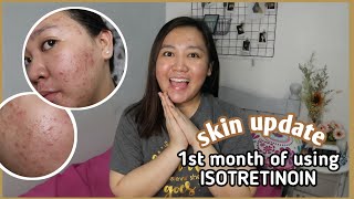 SKIN UPDATE ♡ 1ST MONTH OF MY ISOTRETINOIN JOURNEY [upl. by Ymij]