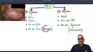 Burkitt Lymphoma httpsyoutubeZBgXLAFtPp8si3PQlcYvLI6ucixkO [upl. by Parry]