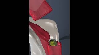 Human Digestive system Epiglottis 3D Animation [upl. by Wettam510]