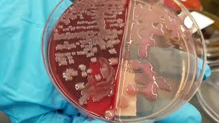 Microbiology Normal versus Pathogenic Bacteria in Urine Wound and Bite Cultures [upl. by Namruht]