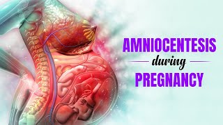 Amniocentesis during Pregnancy  What is it used for and its benefits  3D Guide [upl. by Einiffit]