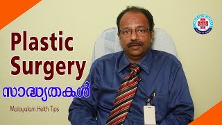 Plastic Surgery  സാദ്ധ്യതകൾ National Plastic Surgery day [upl. by Elleined]