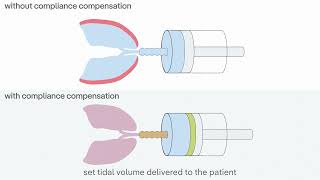 Protective ventilation during pediatric surgery with Atlan anaesthesia workstations [upl. by Swerdna]