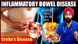 DIET for IBD  Crohns Disease का मेडिकल कारन और इलाज  Explained in HIndi by DrEducation [upl. by Morril]