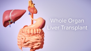 Liver Transplant  Cincinnati Childrens [upl. by Nore286]