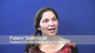 Patient Testimonial  Fractional CO2 Laser Skin Rejuvenation [upl. by Anaek738]