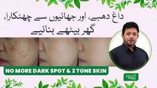 No more Dark Spots amp Two Tone Skin  Pigmentation treatment at home  Dark Spots on Face Removal [upl. by Ange]