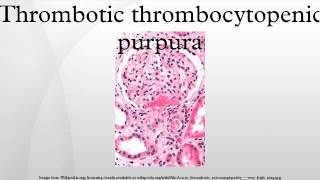 Thrombotic thrombocytopenic purpura [upl. by Ocirnor]