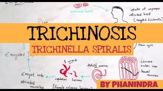 TRICHINOSIS  TRICHINELLA SPIRALIS  STRUCTURE  LIFE CYCLE  SYMPTOMS  BY PHANINDRA GUPTA [upl. by Shane174]