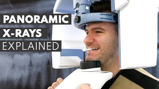 Panoramic Dental XRay Procedure EXPLAINED [upl. by Ayak]