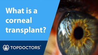 What is a corneal transplant [upl. by Erda]