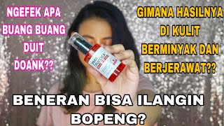 SOME BY MI SNAIL TRUECICA MIRACLE REPAIR SERUM  REVIEW LENGKAP DI KULIT BERMINYAK DAN BERJERAWAT [upl. by Griff]