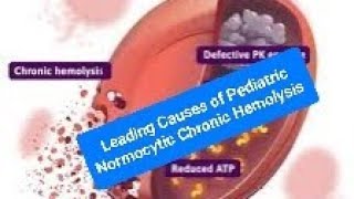 Leading Causes of Pediatric Normocytic Chronic Hemolysis G6PD and PKD [upl. by Witt]