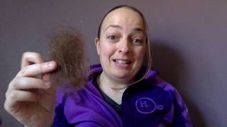 My Hair Loss Story How To Cope Mentally With Alopecia Areata and Telogen Effluvium [upl. by Annauqaj55]