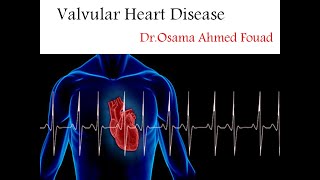 Valvular Heart Disease Part 1 [upl. by Oneida]