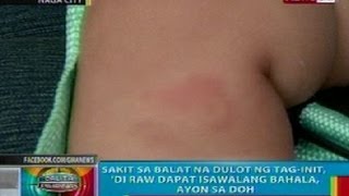 BP Sakit sa balat na dulot ng taginit di dapat isawalang bahala ayon sa DOH [upl. by Liman]