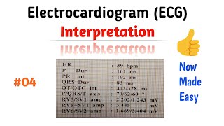 How to Read an ECG interpretation  04 Pwave [upl. by Raymond671]