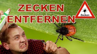 ✅ZECKEN RICHTIG ENTFERNEN  TUTORIAL REVIEW DEUTSCH [upl. by Alliuqaj]