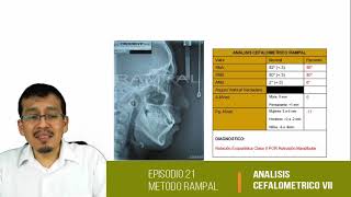 Cefalometría VIII Evaluación de Vertebras Cervicales [upl. by Nyrem]