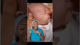 Doctor explains crigler massage to help crusted eyes in babies blockedtearduct newborns [upl. by Notled]