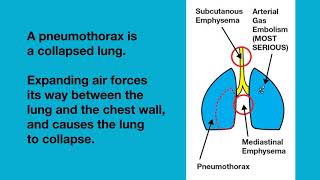 Lung Overexpansion Injuries [upl. by Sally842]