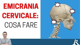 I problemi cervicali possono portare emicrania ecco cosa fare [upl. by Wareing447]