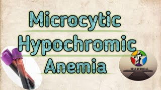 Microcytic Hypochromic Anemia in hindi ll ANEMIA ll Hematology And Blood Banking [upl. by Nnoryt]