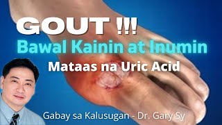 GOUT Bawal Kainin at Inumin  Dr Gary Sy [upl. by Angelia]