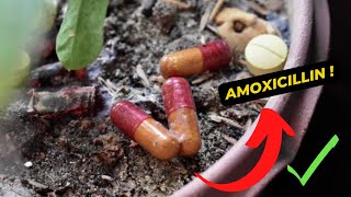 What is amoxicillin used for [upl. by Knick]