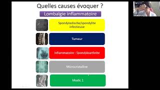 Discopathies inflammatoires Violaine FOLTZ [upl. by Sainana]