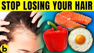 Stop Losing Your Hair By Eating These 8 Foods That Help Prevent Hair Loss [upl. by Akemet]