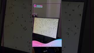 Human Sperm Under Microscope  Shubhashree IVF Clinic  Best IVF in Nepal [upl. by Ynnek]