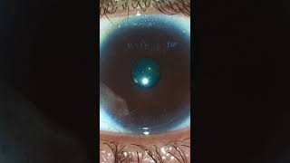 My eye pupil contracting and dilating iris eye pupil science biology body human intraocular [upl. by Pickar]