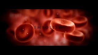 Embolism  Short Film HD [upl. by Ahsennek916]