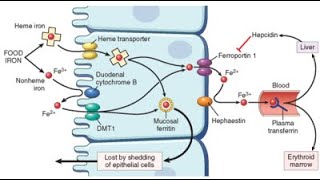 Hypochromic microcytic anemia lecture April 2020 [upl. by Syhr230]