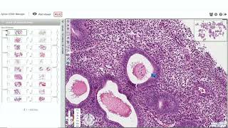 Endometrial Pathology for the Practicing Pathologist by Marisa Rose Nucci MD [upl. by Amahcen]