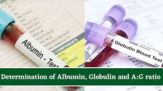 Determination Of Albumin and Globulin Total Protein Test And AlbuminGlobulin AG Ratio [upl. by Acquah]