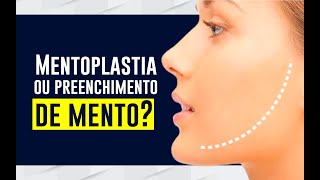 MENTOPLASTIA ou PREENCHIMENTO de mento  Dr Vitor Erlacher [upl. by Lyell373]