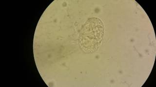 Unfertilised egg of Ascaris lumbricoides [upl. by Atiraj]