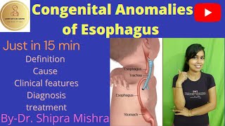 Congenital Anomalies Of Esophagus part1  Tracheoesophageal Fistula Dr Shipra Mishra [upl. by Burdelle]