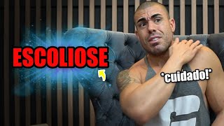 Tudo sobre escoliose [upl. by Alyad]