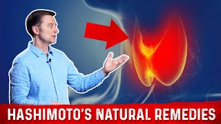 Best Nutrients For Hashimotos Thyroiditis – Dr Berg [upl. by Bolen]