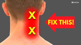 How to Fix Neck Pain off to the Side [upl. by Iver]