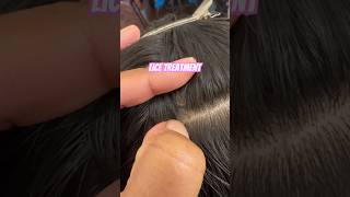 Head lice treatment on a client l head lice removal service [upl. by Myca16]