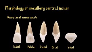 Morphology of maxillary central incisor [upl. by Leuneb]